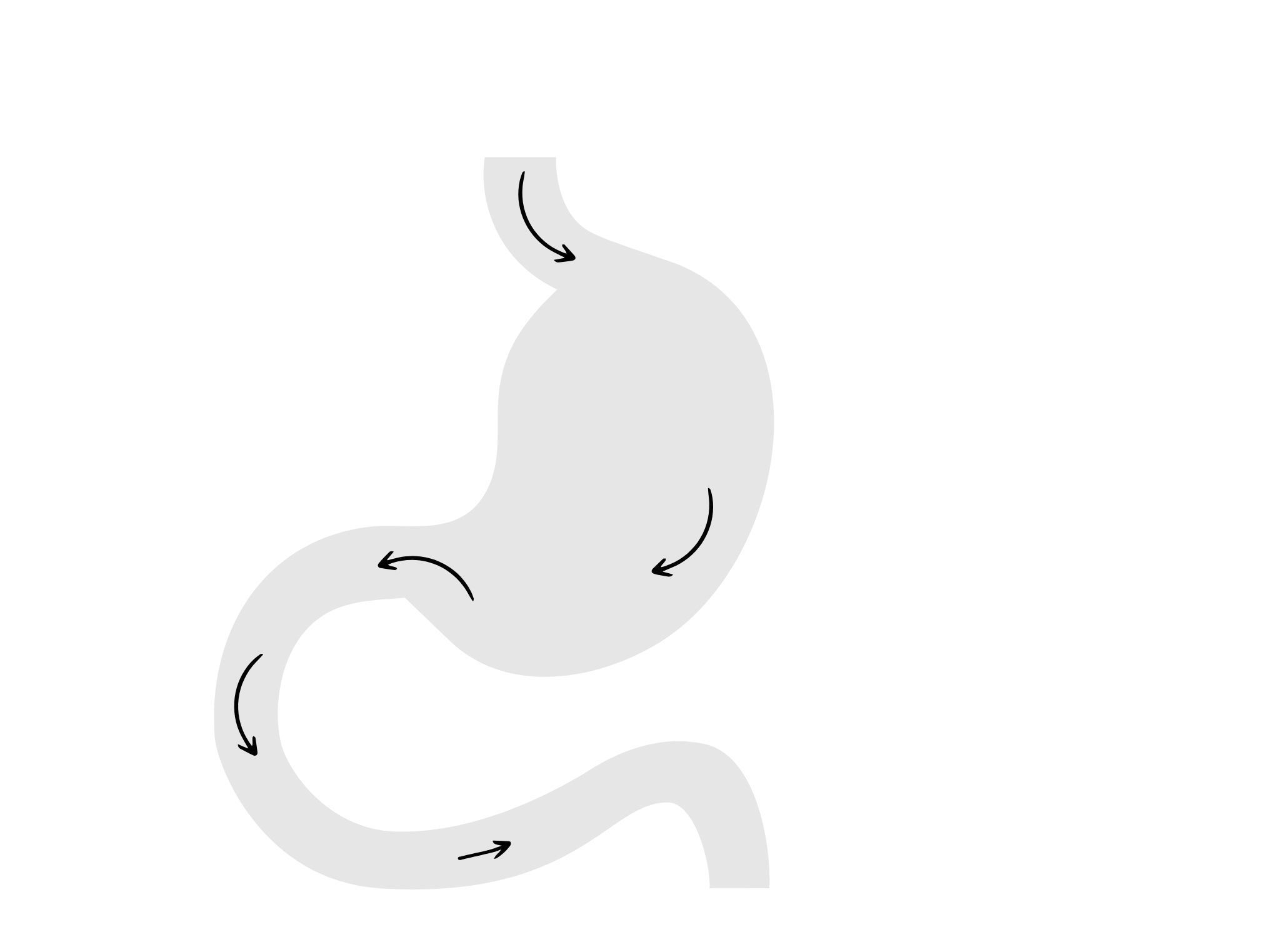 Gastric bypass - przed zabiegiem