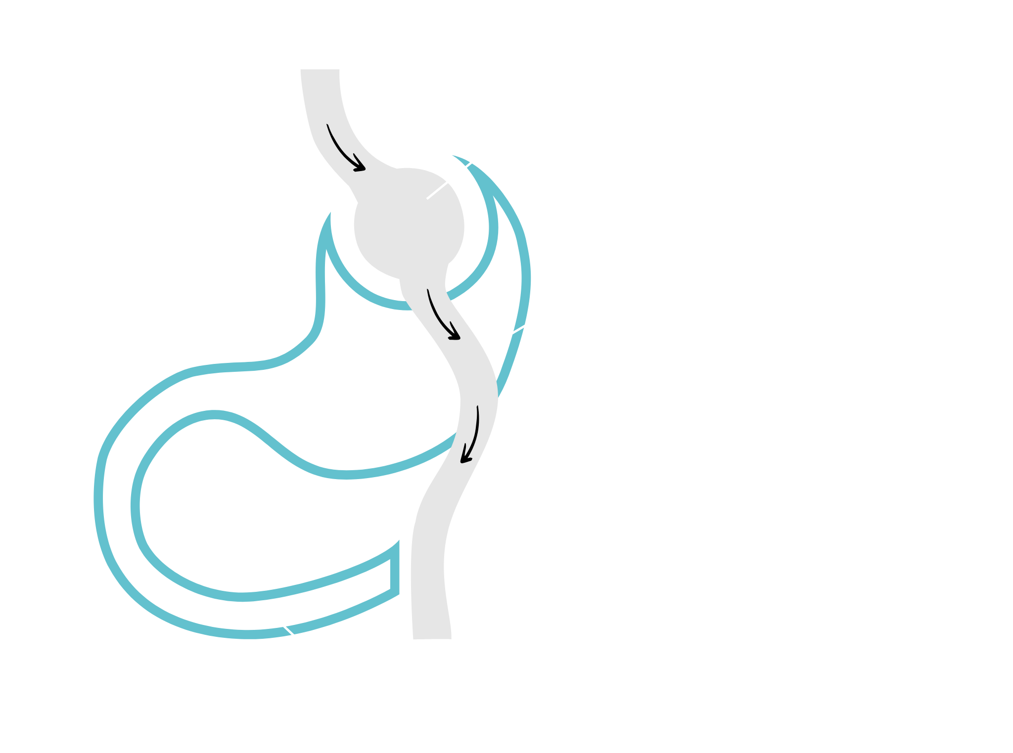 Operacja rewizyjna - po zabiegu