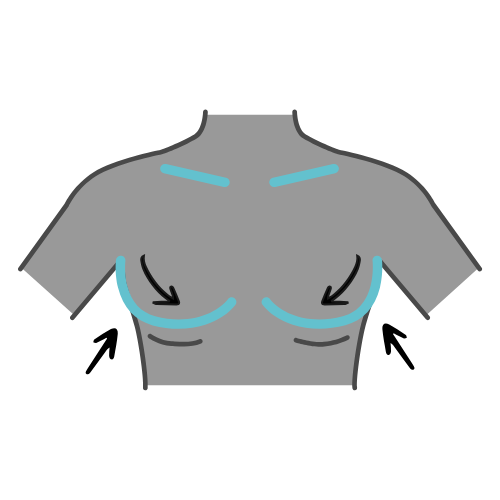 Plastyka klatki piersiowej