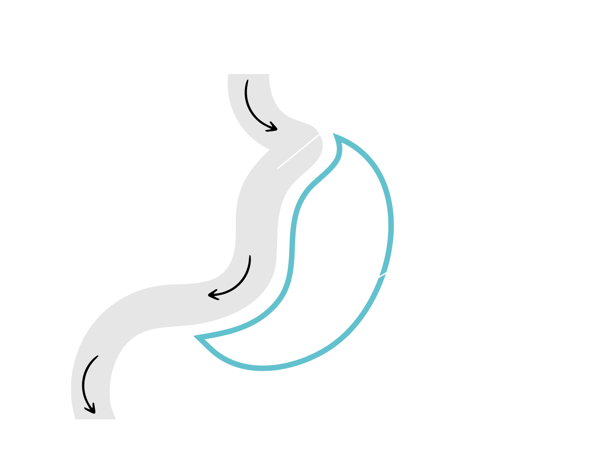 Rękawowa resekcja żołądka - po zabiegu