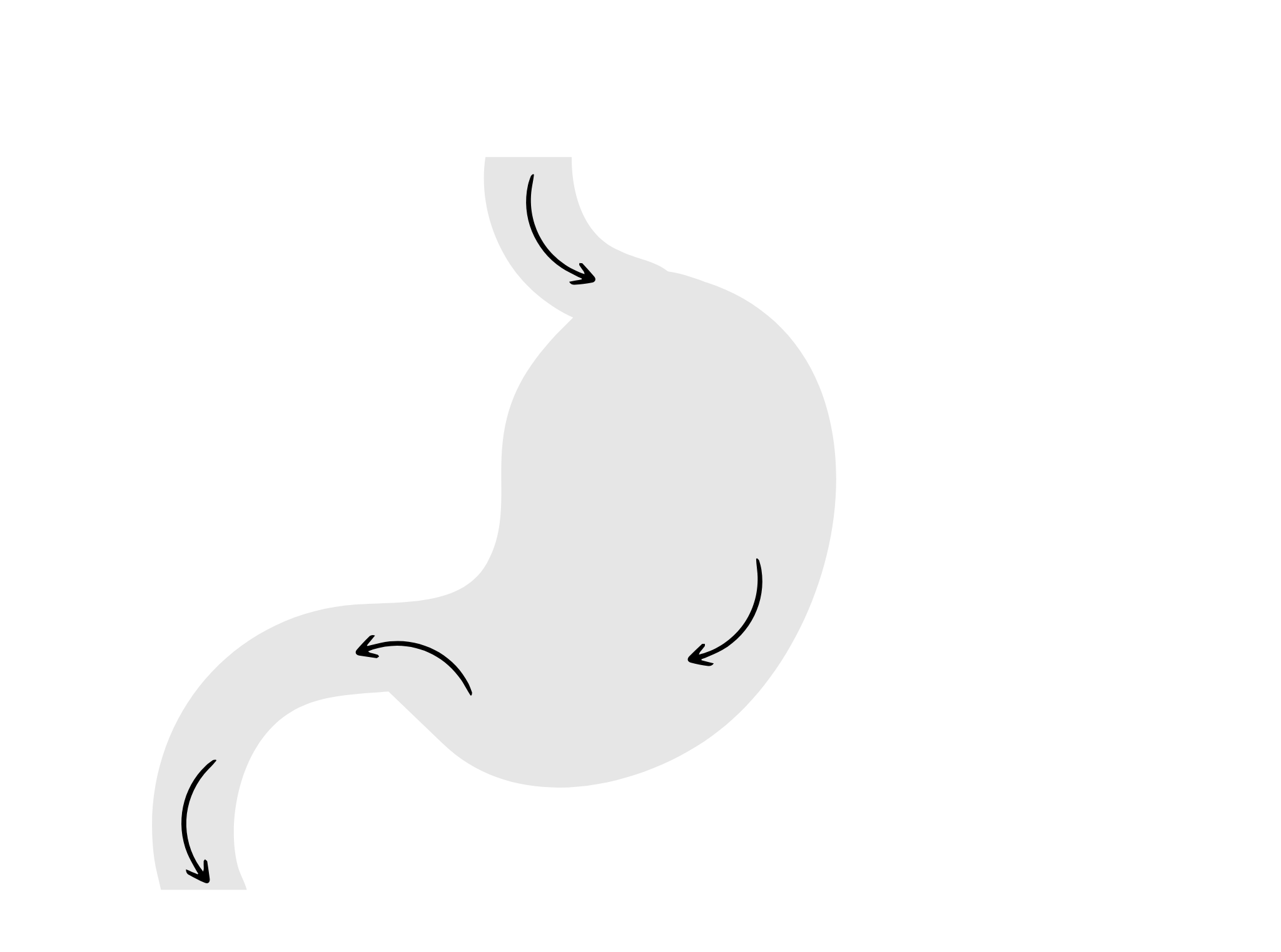 Rękawowa resekcja żołądka - przed zabiegiem